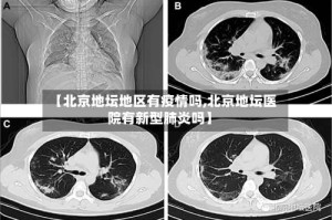 【北京地坛地区有疫情吗,北京地坛医院有新型肺炎吗】