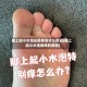 脚上起小水泡还很痒是什么原因(脚上起小水泡很痒的原因)