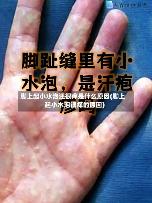 脚上起小水泡还很痒是什么原因(脚上起小水泡很痒的原因)-第2张图片