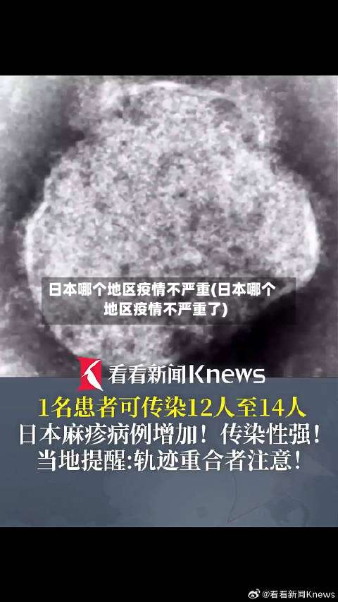 日本哪个地区疫情不严重(日本哪个地区疫情不严重了)-第2张图片